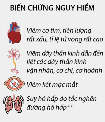 Tìm hiểu về bệnh BẠCH HẦU - Bệnh viện Tai Mũi Họng TPHCM