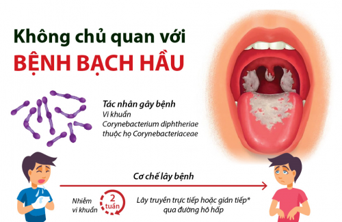 Tìm hiểu về bệnh BẠCH HẦU - Bệnh viện Tai Mũi Họng TPHCM